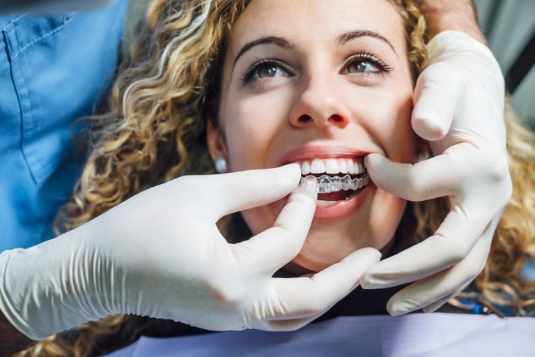 Women Receiving Invisalign Treatment In North York, ON