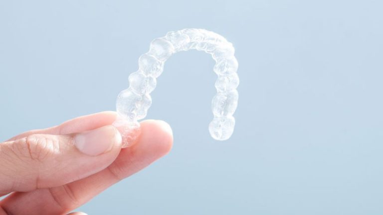 Important Things to Know About Invisalign