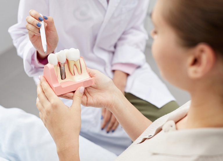 dental implants north york Toronto