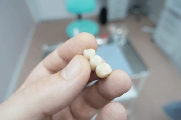 how to get the best value for your dental bridge investment